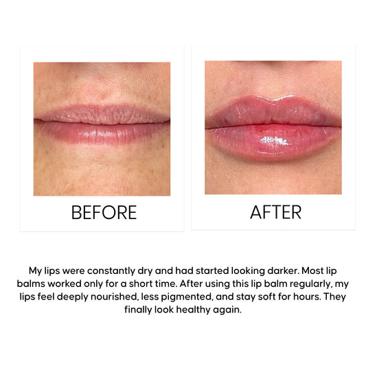 Before and after comparison of lips the effect of a Aqua lip moisturizer for dark lips.