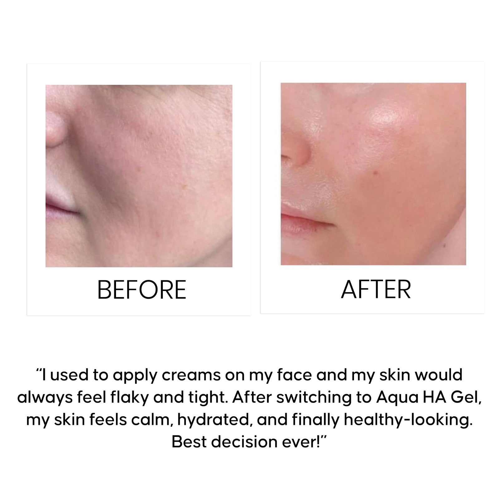Aqua Ace HA Gel Based Face Moisturizer